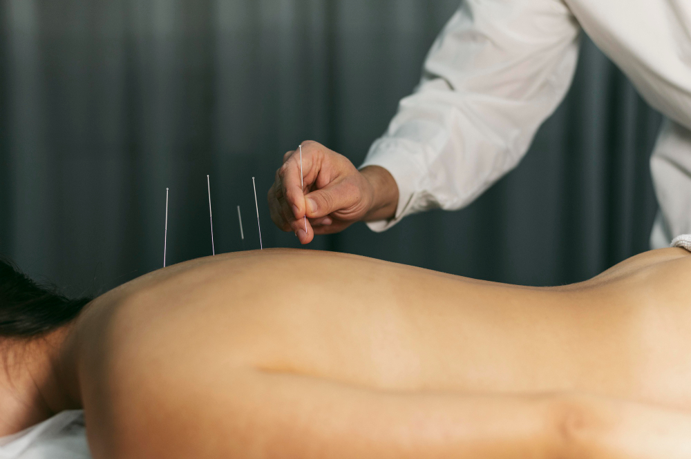 dry needling therapy in hyderabad